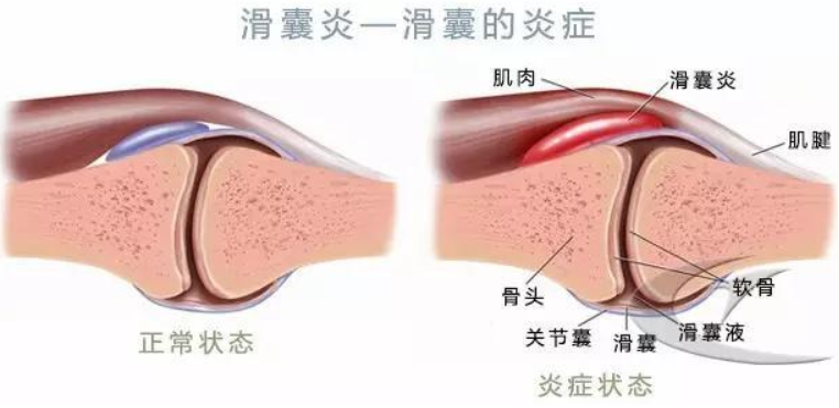 又伤一个！确认撕裂！赛季刚开始，两人倒下了…