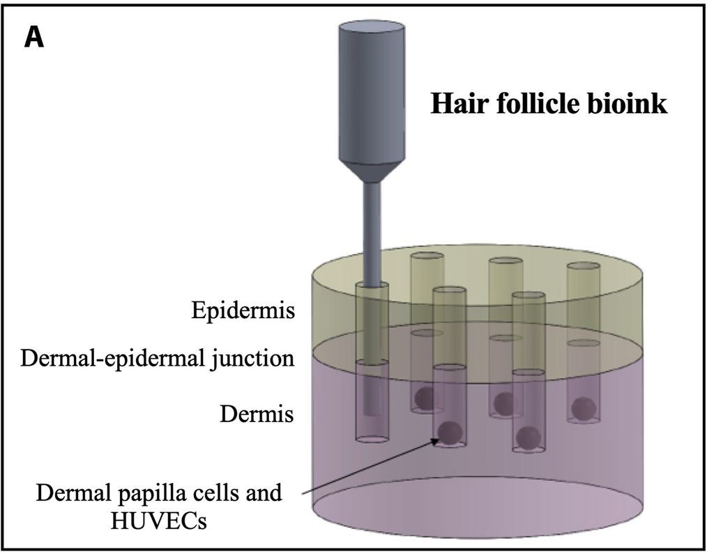 皮肤移植新突破  科学家成功3D生物打印首个功能性毛囊